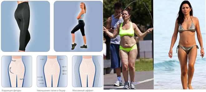 Антицеллюлитное белье для похудения