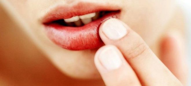 аллергия отек квинке аллергия отек квинке