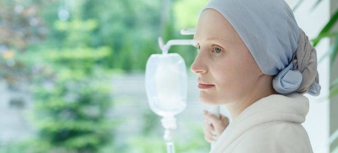 Анагеновая алопеция Анагеновая алопеция