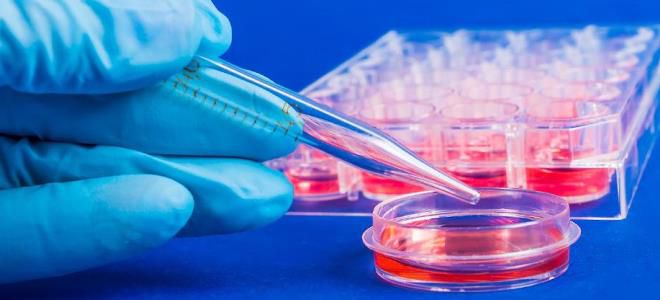 анализ на гемоглобин анализ на гемоглобин