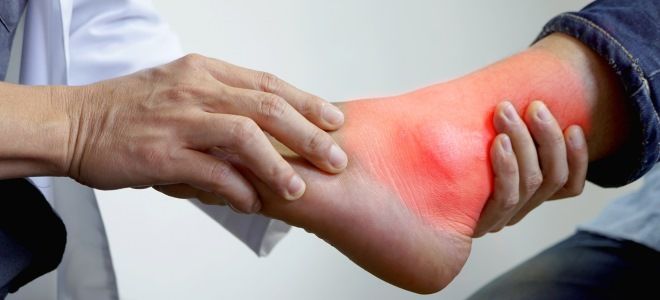 бутадион состав бутадион состав