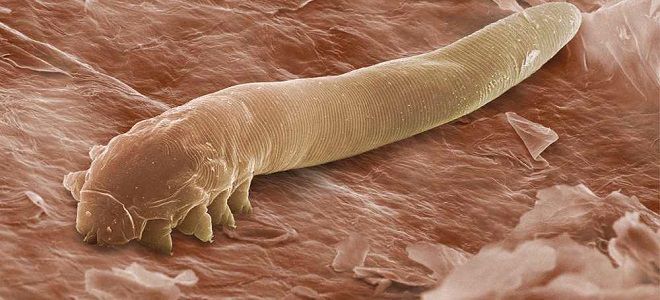 демодекс на лице демодекс на лице