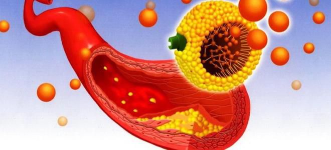 дислипидемия что это за болезнь дислипидемия что это за болезнь