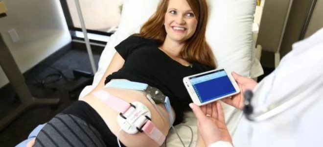 допплерометрия в 3 триместре допплерометрия в 3 триместре