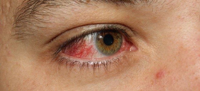 эритромицин аналоги эритромицин аналоги