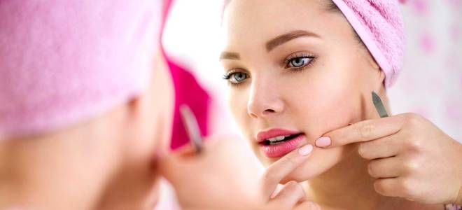 Как правильно выдавливать прыщи Как правильно выдавливать прыщи