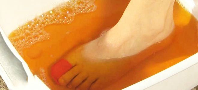 как йод действует на грибок ногтей как йод действует на грибок ногтей