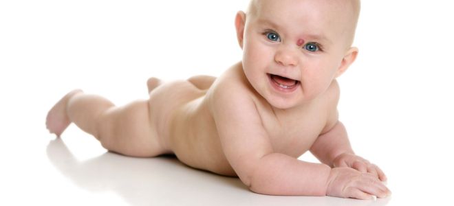 Комбинированная гемангиома у новорожденных Комбинированная гемангиома у новорожденных