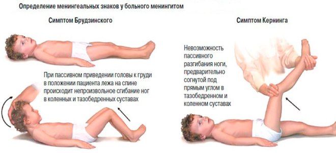 менингит причины менингит причины