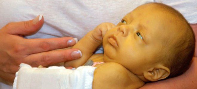 печеночная желтуха патогенез печеночная желтуха патогенез