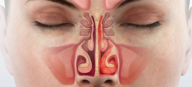 периферическая аносмия периферическая аносмия