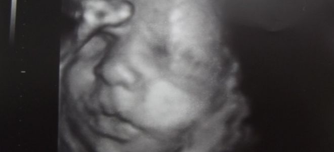 плод 36 недель плод 36 недель