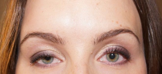 птоз верхнего века причины птоз верхнего века причины