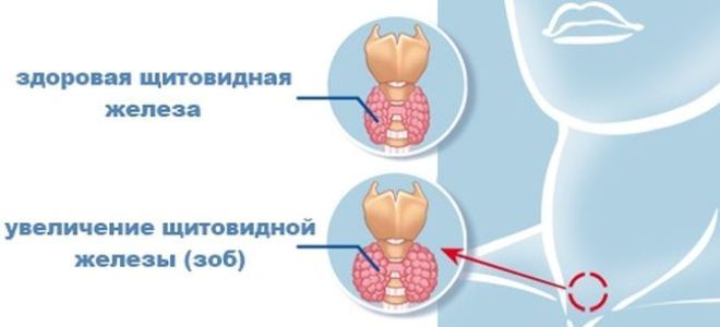 щитовидная железа строение щитовидная железа строение