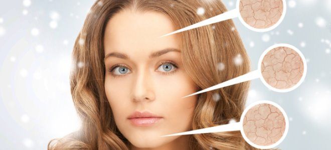 шелушится кожа на лице зимой шелушится кожа на лице зимой