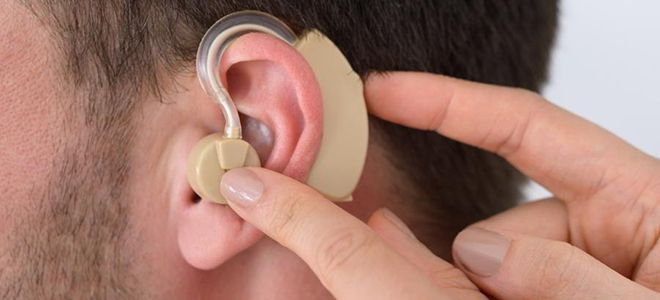 слуховой аппарат или усилитель звука разница слуховой аппарат или усилитель звука разница