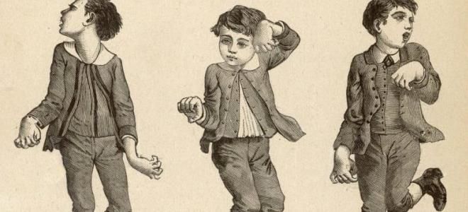 виды гиперкинезов виды гиперкинезов