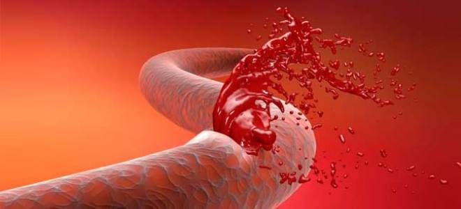 виды гиповолемического шока виды гиповолемического шока