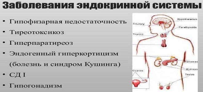 фото1 заболевания эндокринной системы