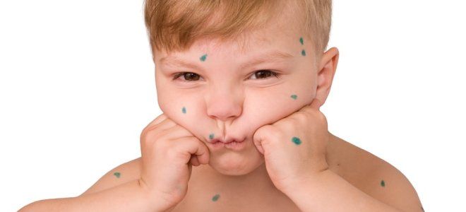 фото2 арбидол сироп детский