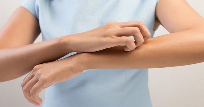 цинокап от псориаза цинокап от псориаза