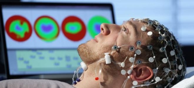 ээг мозга ээг мозга