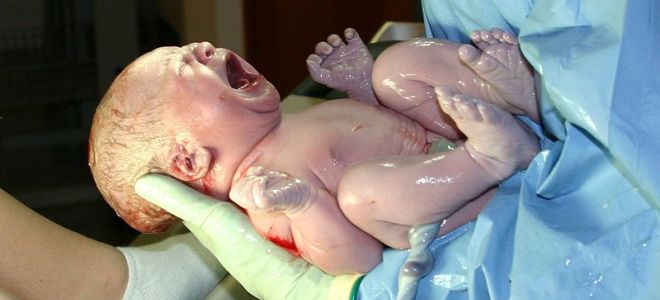 к чему снится принимать роды к чему снится принимать роды