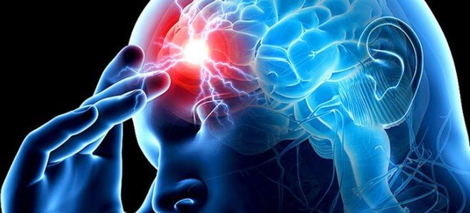 моторная афазия моторная афазия