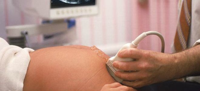 пол по чсс плода пол по чсс плода