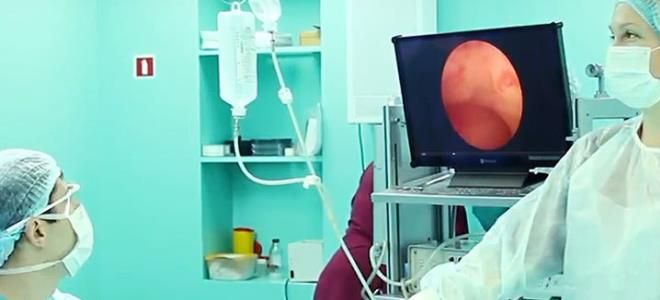 после удаления полипа в матке после удаления полипа в матке