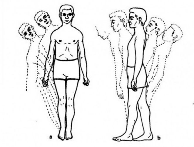 поза ромберга пошатывание что означает поза ромберга пошатывание что означает