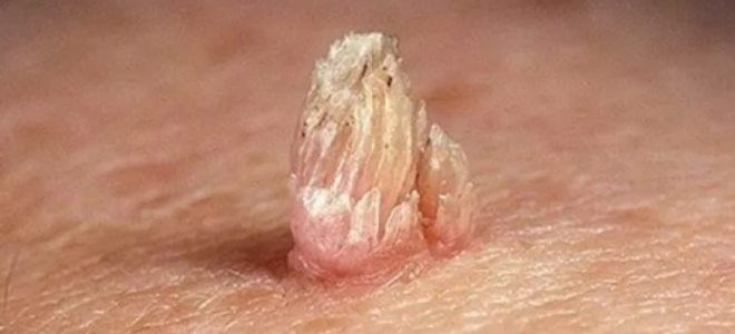 прием циклоферона прием циклоферона