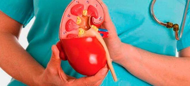 признаки песка в почках признаки песка в почках