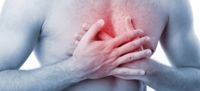 синдром титце диагностика синдром титце диагностика