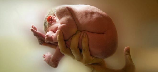 течение родов при тазовом предлежании течение родов при тазовом предлежании