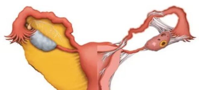 возрастная инволюция возрастная инволюция