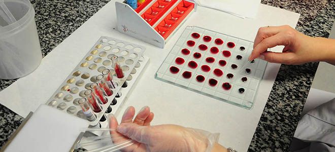 анализ на резус фактор анализ на резус фактор