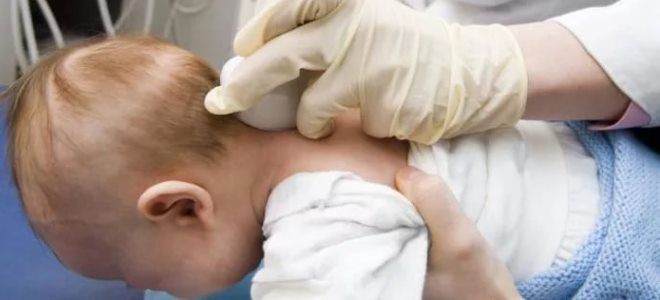 церебральная ишемия у новорожденных церебральная ишемия у новорожденных