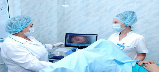 что такое лейкоплакия что такое лейкоплакия