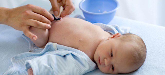 обработка пупочной ранки при омфалите обработка пупочной ранки при омфалите