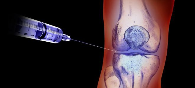 повреждение мениска коленного сустава лечение повреждение мениска коленного сустава лечение