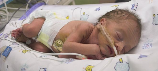 ребенок в 36 недель ребенок в 36 недель