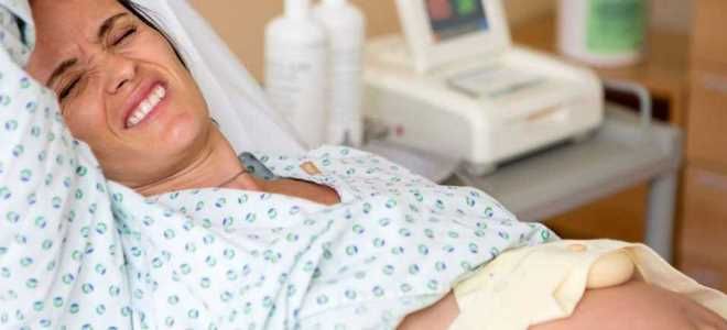 слабые схватки слабые схватки