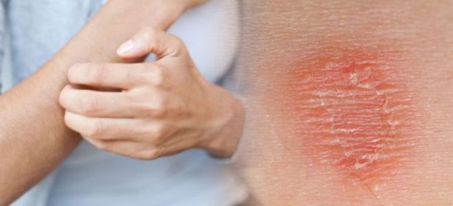 таблетки глево таблетки глево