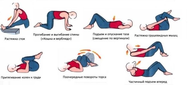 Вертеброгенная люмбоишиалгия лечебная физкультура Вертеброгенная люмбоишиалгия лечебная физкультура