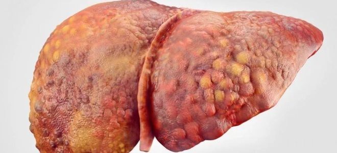 заражение детей гепатитом заражение детей гепатитом