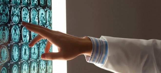 диагностика нарушений памяти диагностика нарушений памяти