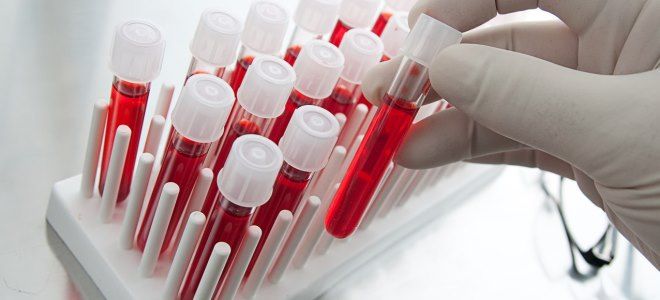 ночной кашель диагностика ночной кашель диагностика