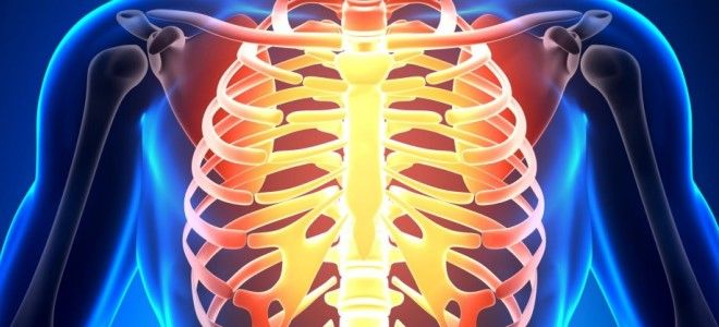 синдром титце лечение синдром титце лечение