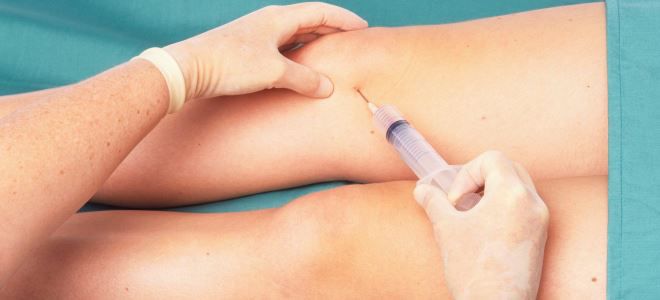 уколы для суставов уколы для суставов